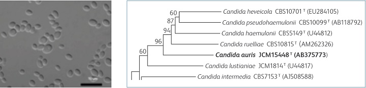 Candida auris（文献1より引用） 図1　26S rDNA D1/D2ドメイン塩基配列データを基にした分子系統的分類( 文献1より引用）