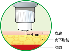 マイクロファイン プロ 32g 4mm ペン型注入器用注射針 日本bd