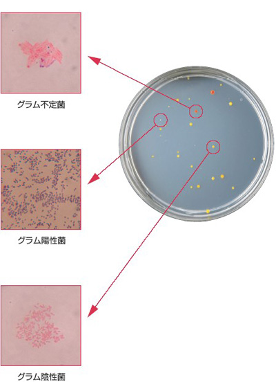 l R2a寒天培地 水環境中の生菌数測定用培地 日本bd l R2a寒天培地 水環境中の生菌数測定用培地 日本bd