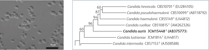 Candida auris（文献1より引用） 図1　26S rDNA D1/D2ドメイン塩基配列データを基にした分子系統的分類( 文献1より引用）