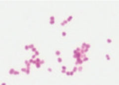 図1　淋菌のグラム染色像