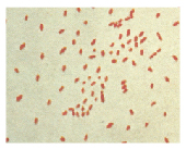 https://upload.wikimedia.org/wikipedia/ commons/8/82/Bordetella_pertussis.jpg